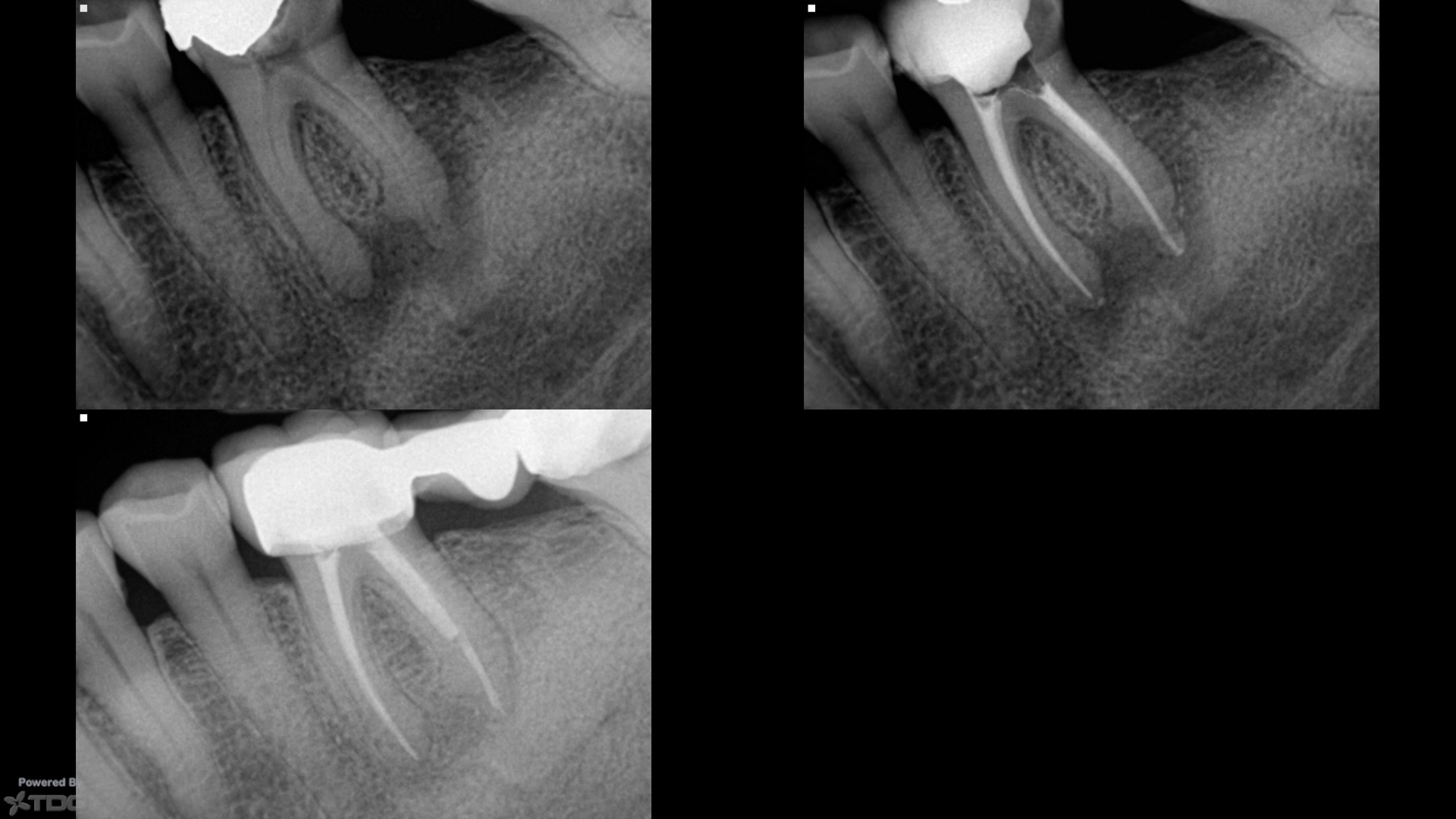 Big Apple Endodontics