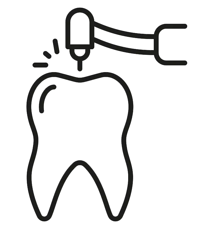 Root Canal Treatment (Initial Rct) Root Canal Treatment (Initial Rct)