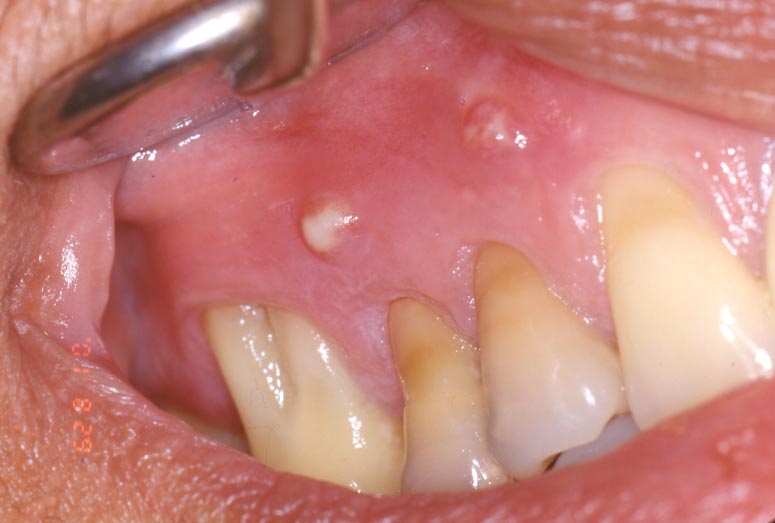 Big Apple Endodontics